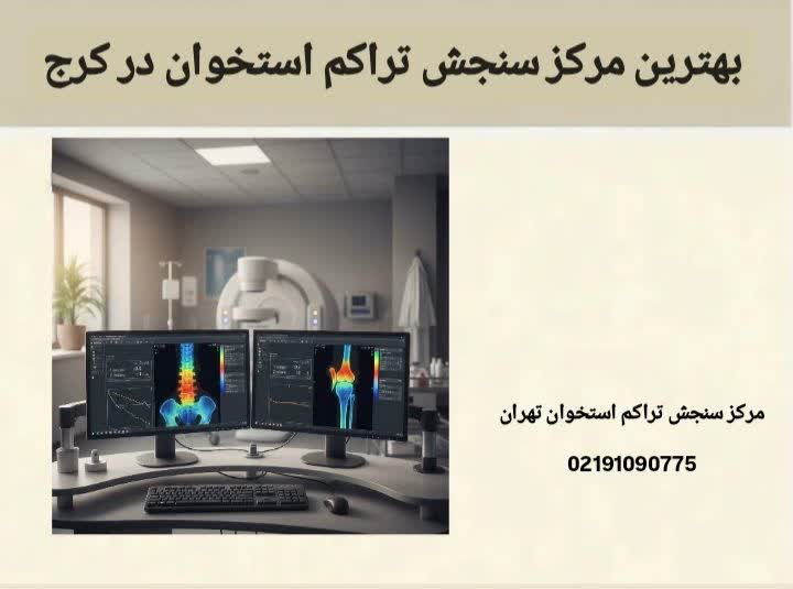 بهترین مرکز سنجش تراکم استخوان در کرج
