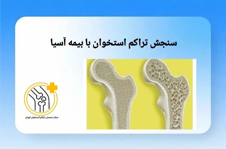 معرفی مراکز سنجش تراکم استخوان که خدمات خود را با بیمه آسیا ارائه میدهند. مراکز سنجش تراکم استخوان طرف قرارداد بیمه آسیا