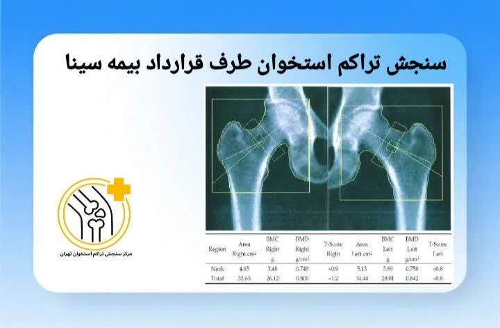مراکز سنجش تراکم استخوان طرف قرارداد بیمه سینا