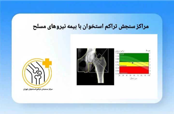 در این بخش مراکزی معرفی میشوند که خدمات سنجش تراکم استخوان را برای بیمهشدگان نیروهای مسلح ارائه میدهند. مراکز سنجش تراکم استخوان طرف قرارداد بیمه البرز