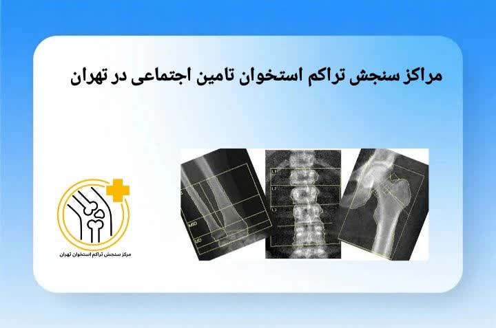 مراکز سنجش تراکم استخوان تامین اجتماعی در تهران