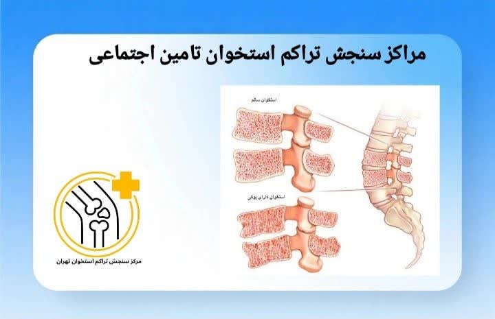 معرفی مراکز سنجش تراکم استخوان طرف قرارداد بیمه تأمین اجتماعی در مناطق مختلف. مراکز سنجش تراکم استخوان طرف قرارداد بیمه سامان