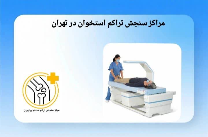 راهنمای کامل مراکز سنجش تراکم استخوان در تهران با دسترسی آسان. مراکز سنجش تراکم استخوان در تهران