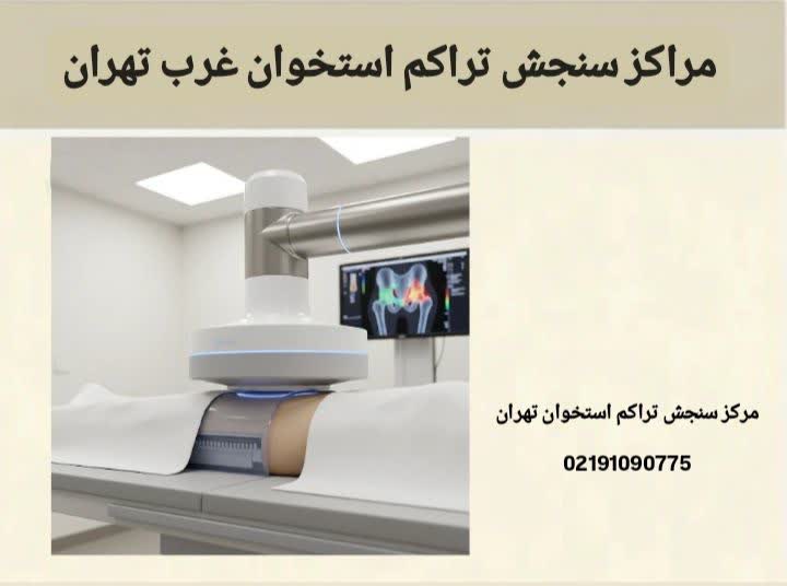 مراکز سنجش تراکم استخوان در غرب تهران