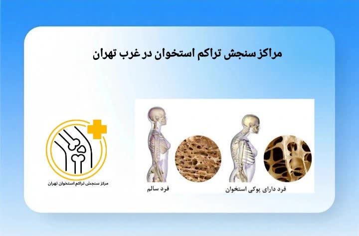 این بخش به معرفی مراکز معتبر سنجش تراکم استخوان در محدوده غرب تهران میپردازد تا انتخاب برای بیماران سادهتر شود. مراکز سنجش تراکم استخوان در غرب تهران