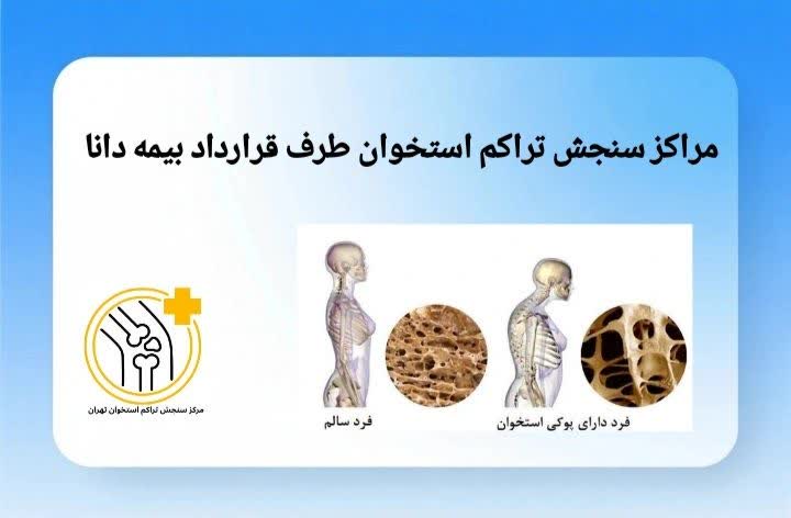 لیستی از مراکز سنجش تراکم استخوان در تهران که با بیمه دانا همکاری دارند. مراکز سنجش تراکم استخوان طرف قرارداد بیمه دانا تهران