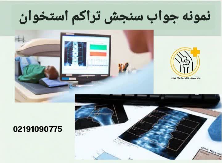 نمونه جواب سنجش تست تراکم استخوان