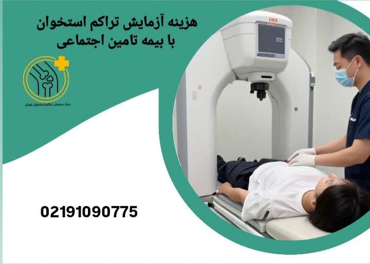 سهم بیمار از هزینه تراکم استخوان با بیمه تامین اجتماعی هزینه سنجش تراکم استخوان آزاد