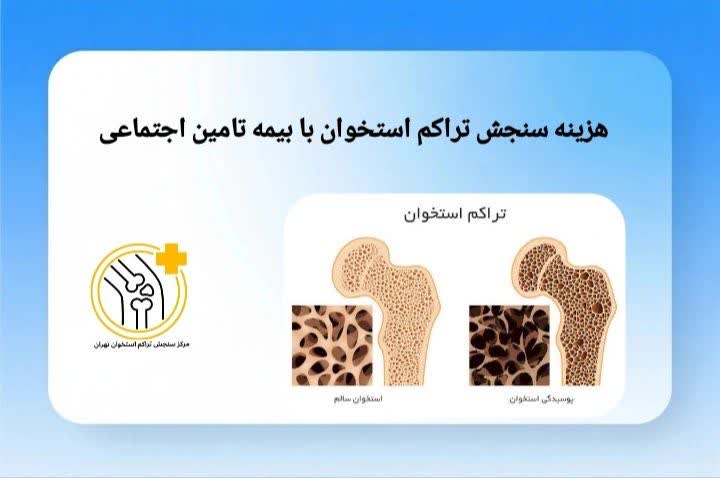  هزینه سنجش تراکم استخوان با بیمه دانا