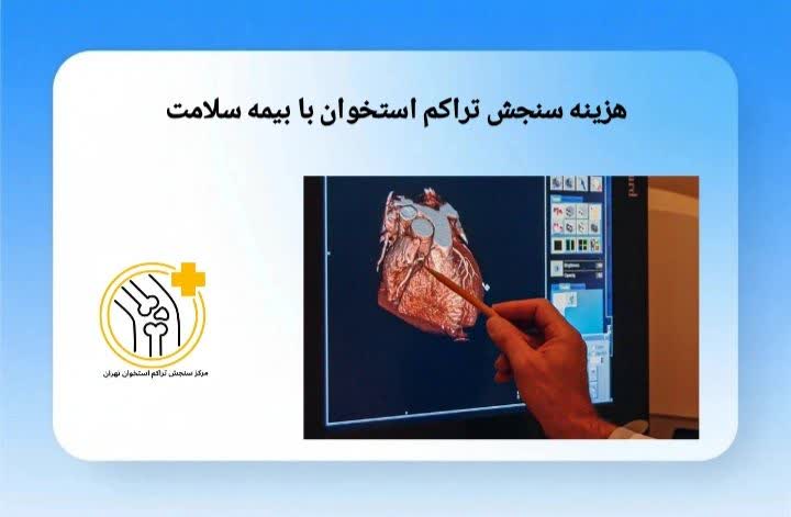 هزینه آزمایش تراکم استخوان با بیمه سلامت