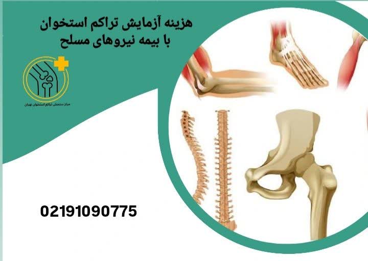 پوشش هزینه تراکم استخوان با بیمه نیروهای مسلح هزینه آزمایش تراکم استخوان با بیمه نیروهای مسلح