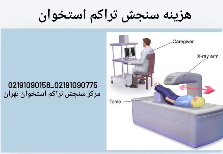  هزینه آزمایش تراکم استخوان