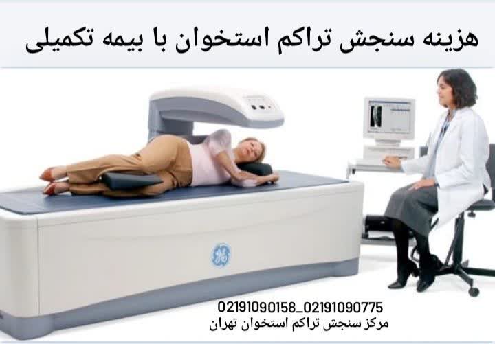 هزینه سنجش تراکم استخوان با بیمه تکمیلی