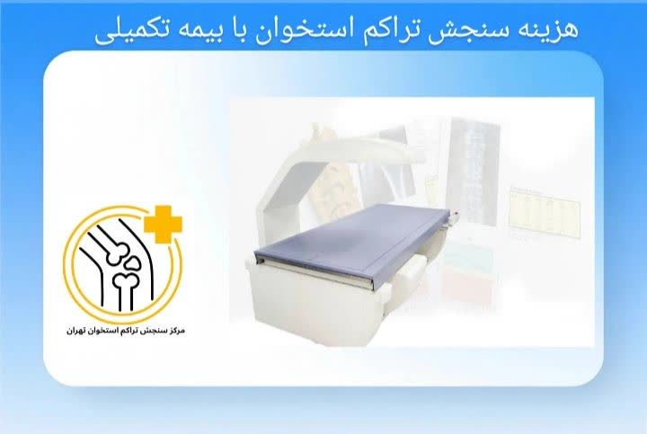 هزینه سنجش تراکم استخوان با بیمه تکمیلی
