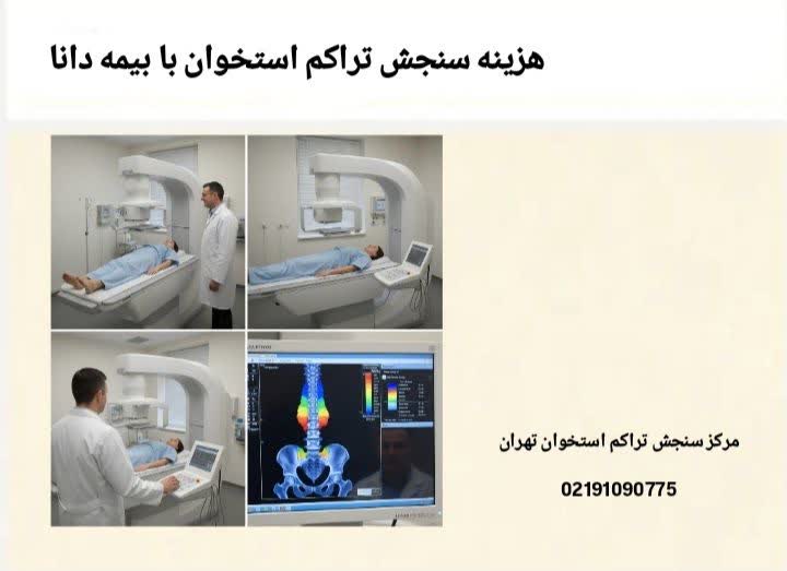 هزینه سنجش تراکم استخوان با بیمه‌ دانا