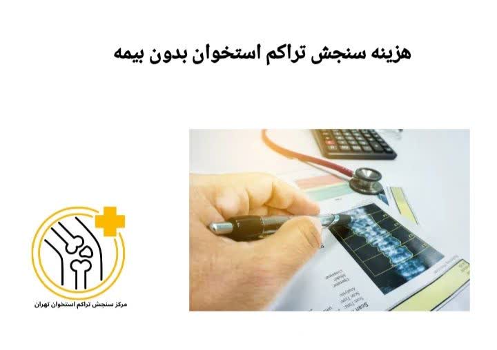 در این عنوان، هزینه سنجش تراکم استخوان بهصورت آزاد و بدون پوشش بیمه بررسی میشود. هزینه سنجش تراکم استخوان بدون بیمه (آزاد)