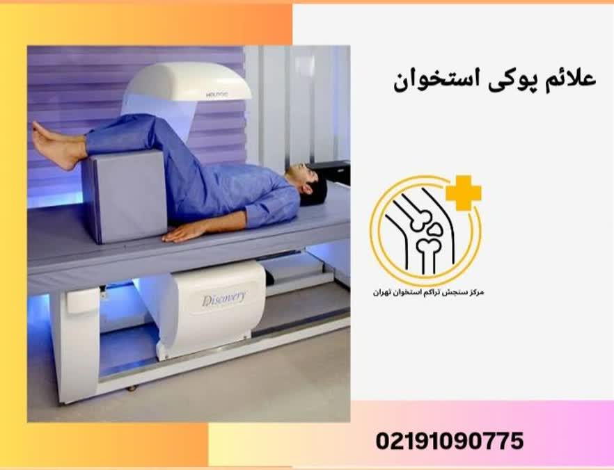 علائم پوکی استخوان