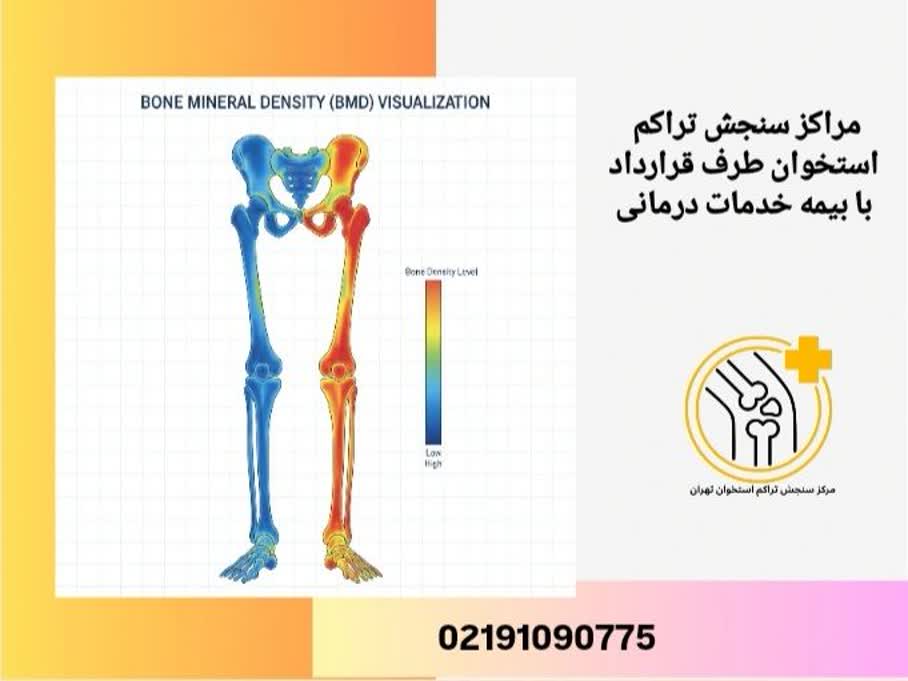 مراکز سنجش تراکم استخوان با بیمه خدمات درمانی