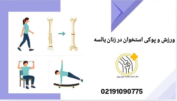 در دوران یائسگی، کاهش استروژن باعث افت تراکم استخوان میشود و ورزش یکی از مؤثرترین راههای کنترل آن است. تاثیر ورزش بر تراکم استخوان