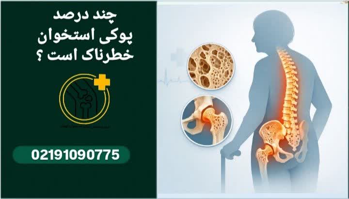 چند درصد پوکی استخوان خطرناک است؟