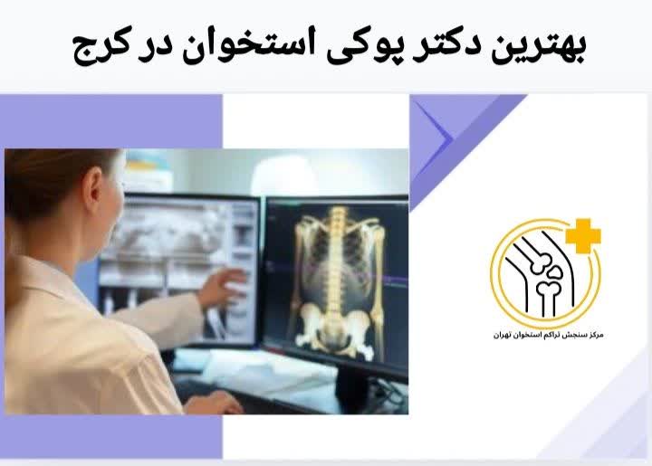 پزشک ممتاز کنترل پوکی استخوان بهترین دکتر پوکی استخوان در کرج