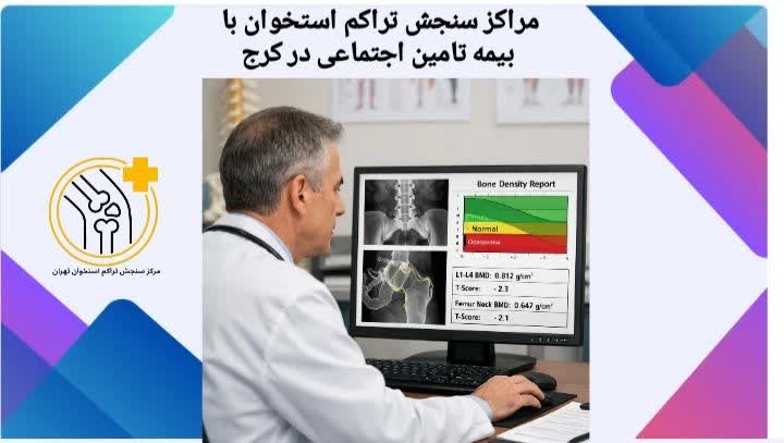 مراکز سنجش تراکم استخوان با بیمه تامین اجتماعی در کرج