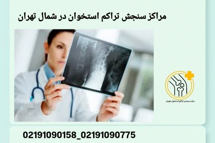 مراکز سنجش تراکم استخوان در شمال تهران