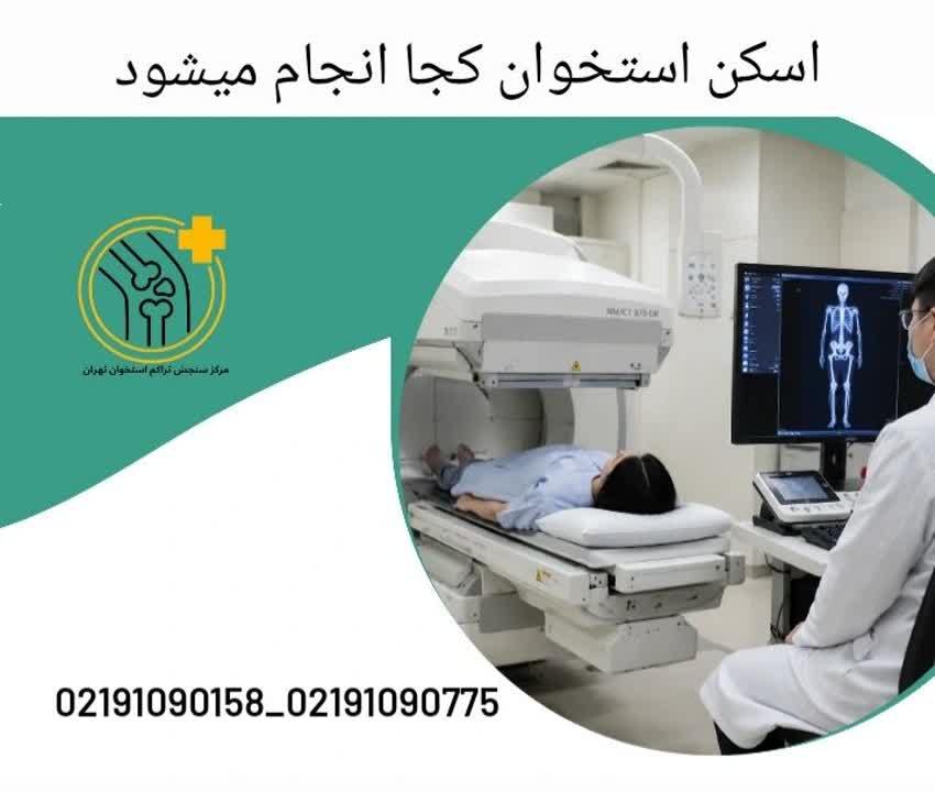 اسکن استخوان کجا انجام میشود