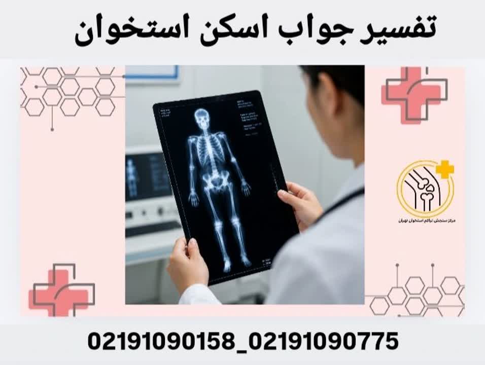 تفسیر جواب اسکن استخوان