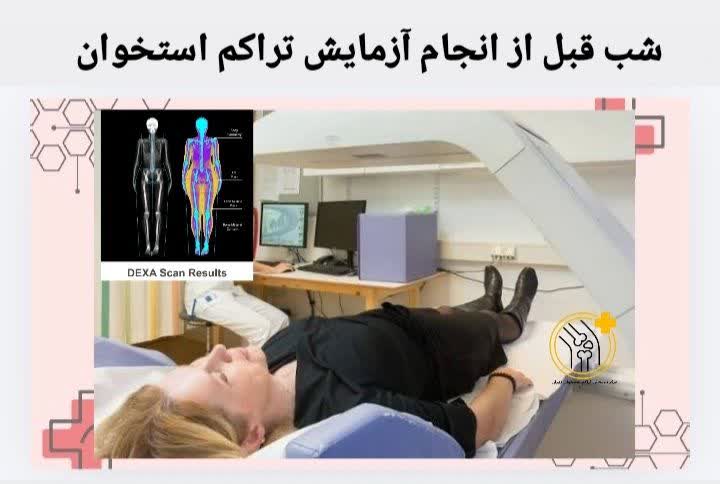  شب قبل از آزمایش تراکم استخوان