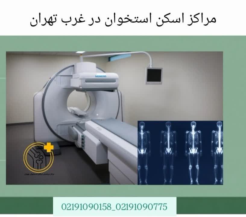 معرفی مراکز انجام اسکن استخوان در مناطق غربی تهران مراکز اسکن استخوان در غرب تهران
