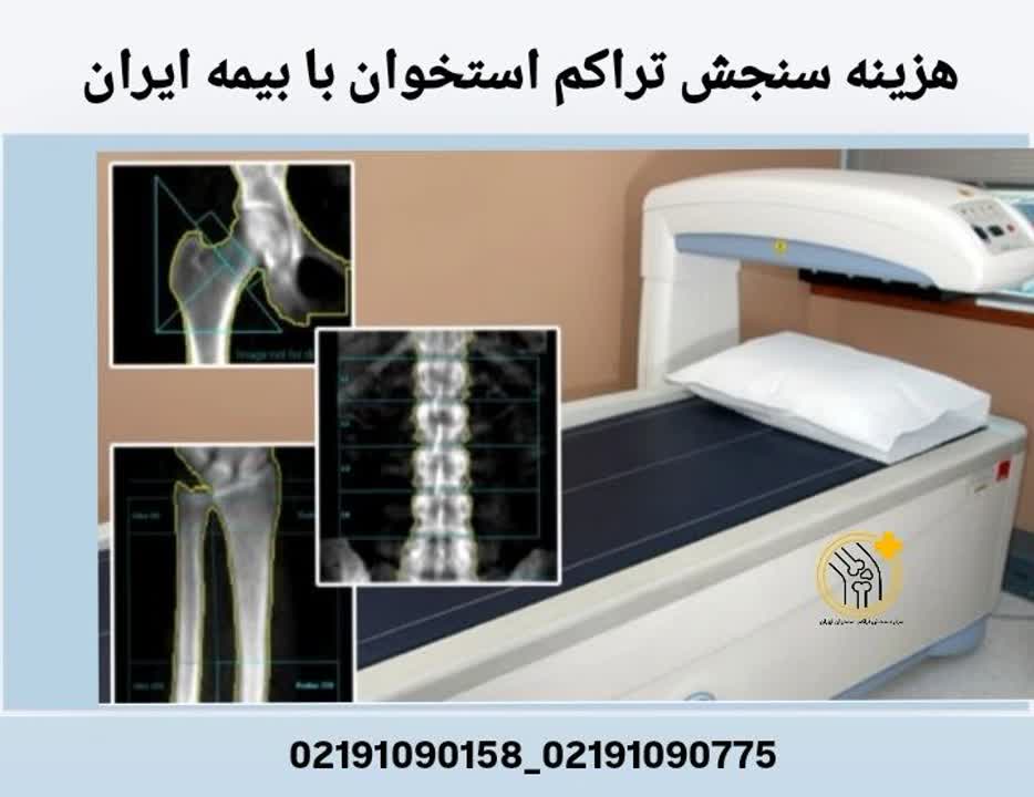 در این بخش میتوانید از حدود هزینه سنجش تراکم استخوان و نحوه کاهش هزینهها با بیمه ایران مطلع شوید. هزینه سنجش تراکم استخوان با بیمه ایران