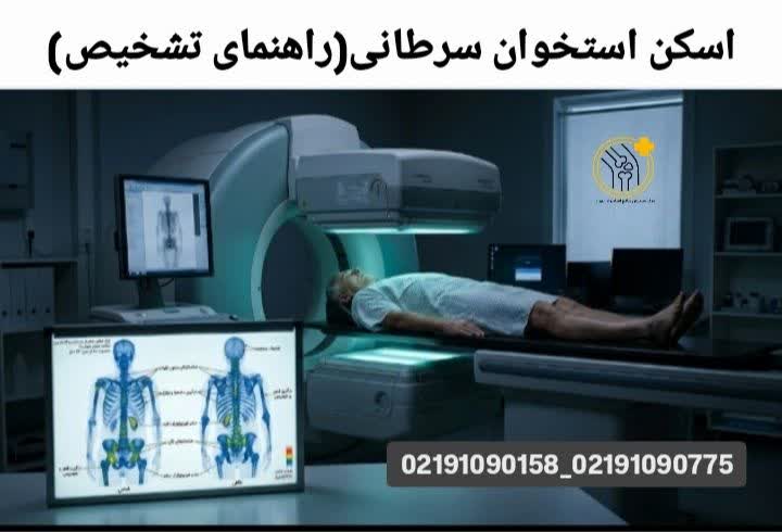 اسکن استخوان سرطانی با نقاط مشکوک