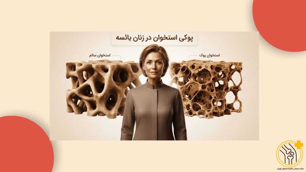  تراکم استخوان کجا انجام می‌شود
